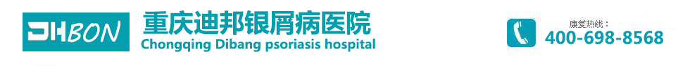 重庆迪邦牛皮癣医院