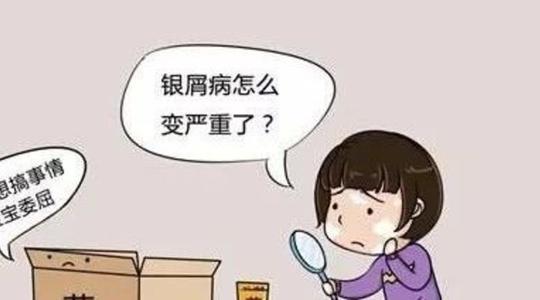 牛皮癣要怎么进行科学护理